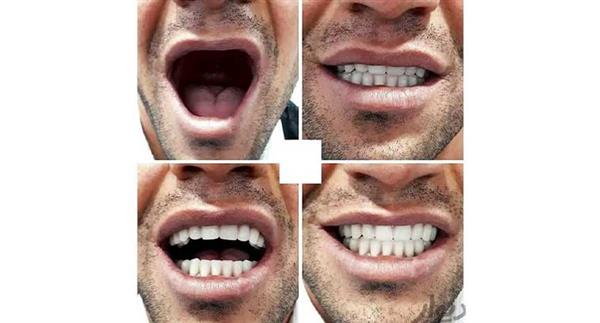 دندانسازی مهدوی-همدان-همدان-دندان پزشکی-بلنگو