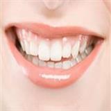 زیبایی دندان لومینیرز
