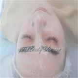 فیشیال تخصصی صورت