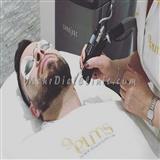 لیزر مو های زائد غرب تهران