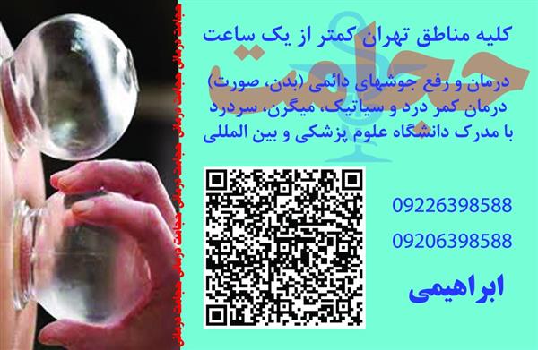 حجامت و بادکش کل تهران-تهران-تهران-خدمات منزل-بلنگو