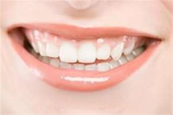 زیبایی دندان لومینیرز-تهران-تهران-دندان پزشکی-بلنگو